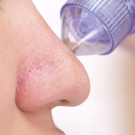 Blackhead Remover Vacuum