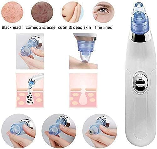 Blackhead Remover Vacuum